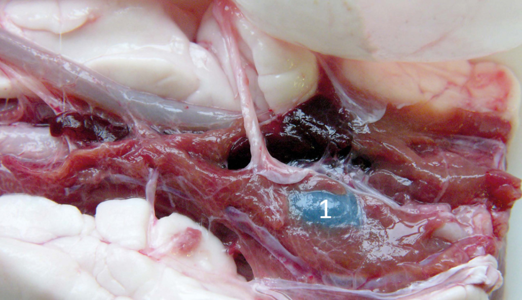 Leber und Gallenblase