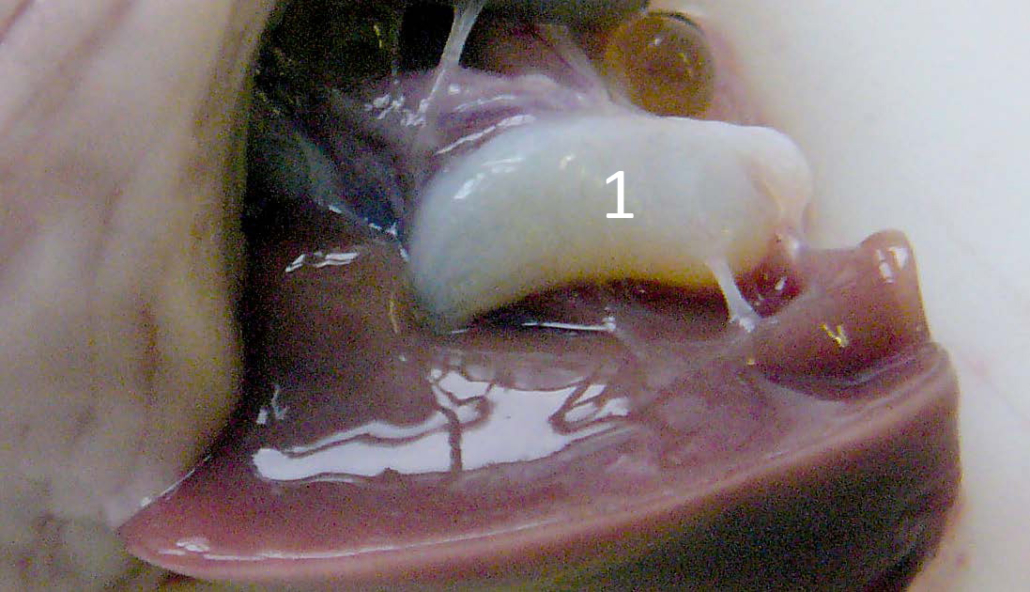 Leber und Gallenblase