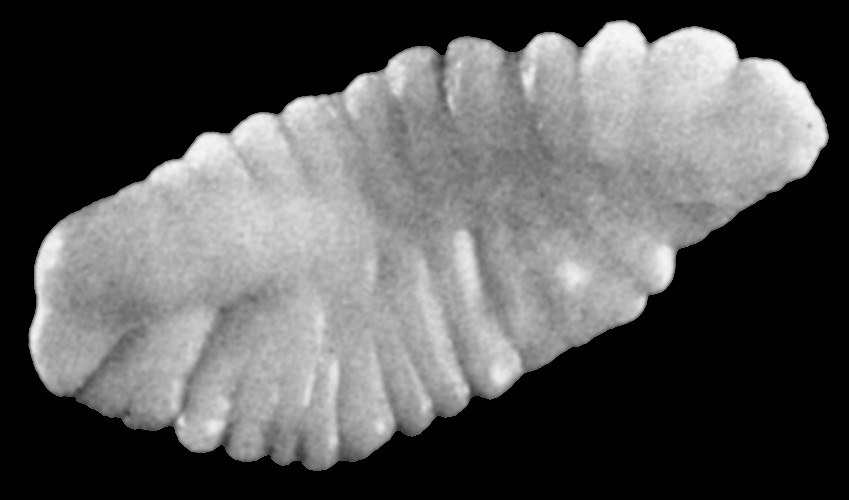 otolith